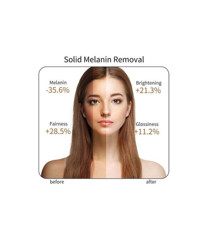 Vitamin C Serum (Original)